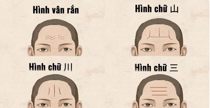 Nhận Biết Bệnh Tiêu Hóa Qua Tướng Mặt: Giải Mã Dấu Hiệu 2 Nhận biết bệnh tiêu hóa qua tướng mặt: Những dấu hiệu cảnh báo cần lưu ý