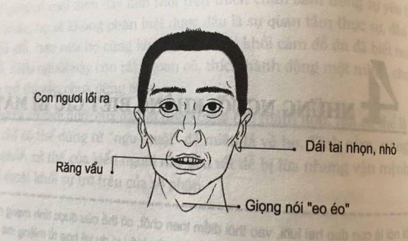 Tướng Người Rộng Lượng: Nhận Biết Và Giải Mã Chi Tiết Nhất 3 Ý nghĩa của tướng người rộng lượng trong cuộc sống hiện đại