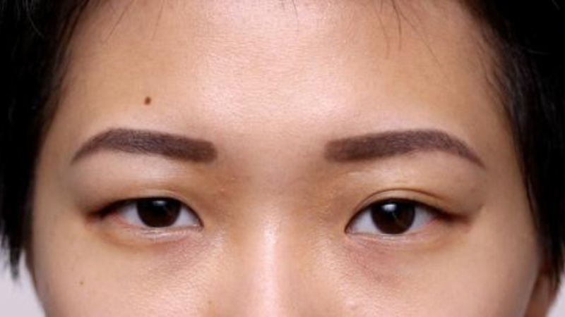 Dấu Hiệu Khuôn Mặt Trước Khi Gặp Vận Xui: Giải Mã Mới Nhất 3 Dấu hiệu nhận biết trên khuôn mặt: Phân tích chuyên sâu từng vùng