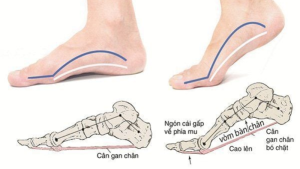 Vòm bàn chân cao thấp và vận mệnh: Góc nhìn từ nhân tướng học
