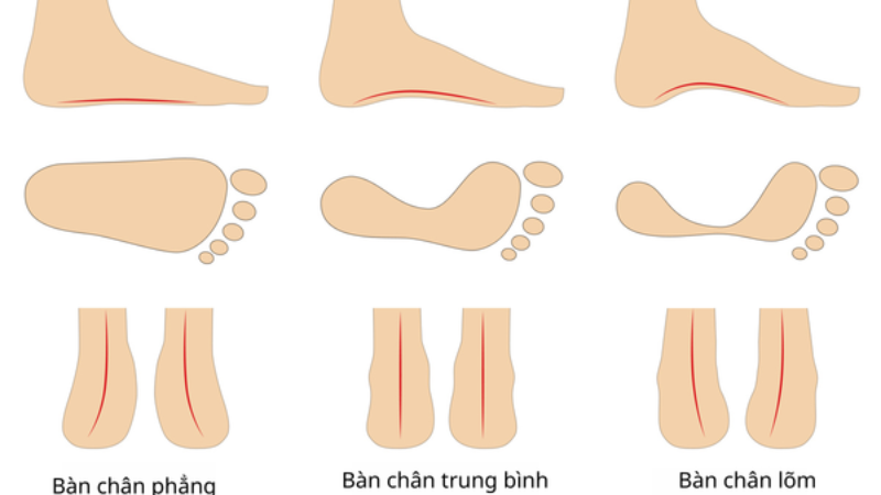 Vòm Bàn Chân Cao Thấp Và Vận Mệnh: Giải Mã Chi Tiết 4 Ảnh hưởng của vòm bàn chân đối với phong thủy và tài lộc