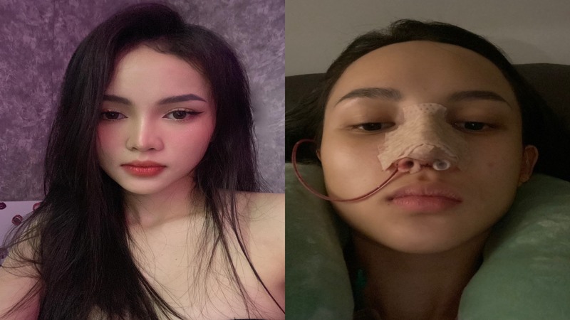 Những lưu ý khi lựa chọn phẫu thuật thẩm mỹ để cải tướng đổi vận