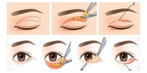 Phân biệt tướng mắt to mắt nhỏ trong Nhân tướng học Nhật Bản